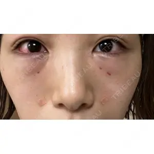 東京エビスクリニック口コミ