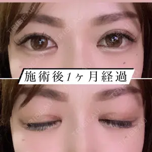 TCB東京中央美容外科 TCB東京中央美容外科 町田院口コミ