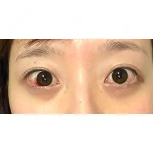 APOLLO BEAUTY CLINIC口コミ