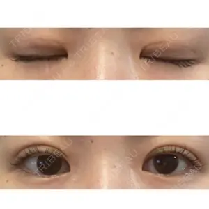 東京BELLEZZAクリニック口コミ