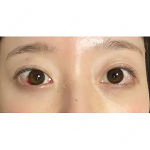 APOLLO BEAUTY CLINIC口コミ