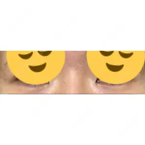 フィラークリニック フィラークリニック 町田院口コミ