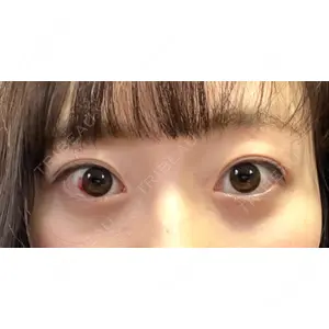 APOLLO BEAUTY CLINIC口コミ