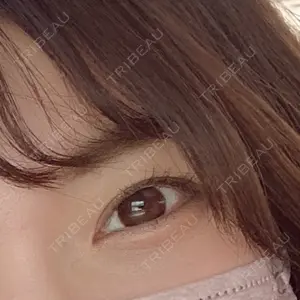 東京BELLEZZAクリニック口コミ