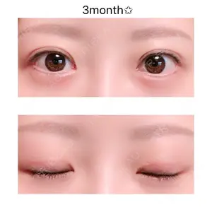 口コミ