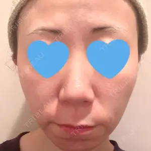口コミ