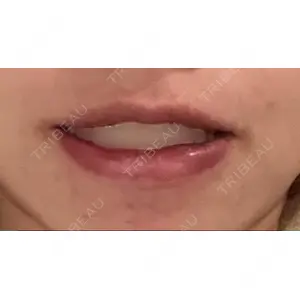 口コミ