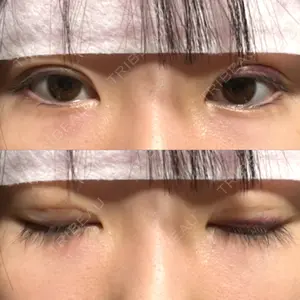 口コミ