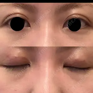 口コミ