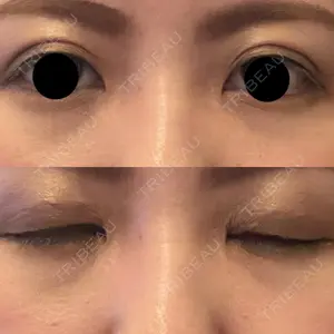 口コミ