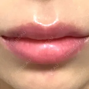 口コミ