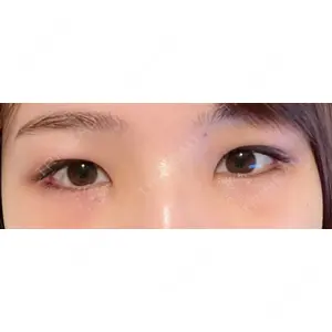 APOLLO BEAUTY CLINIC口コミ