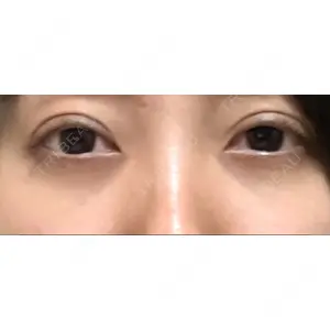 APOLLO BEAUTY CLINIC口コミ