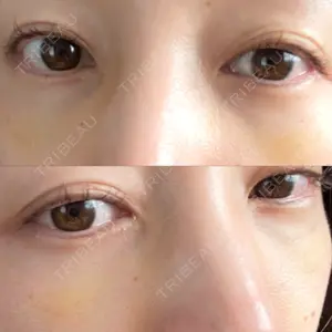 APOLLO BEAUTY CLINIC口コミ