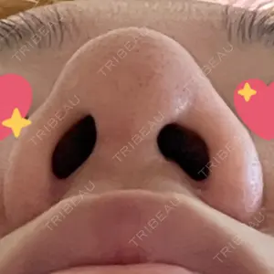 湘南美容クリニック 湘南美容クリニック 池袋西口院口コミ