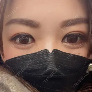 TCB東京中央美容外科 TCB東京中央美容外科 町田院口コミ