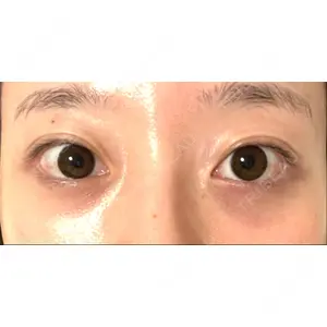 APOLLO BEAUTY CLINIC口コミ