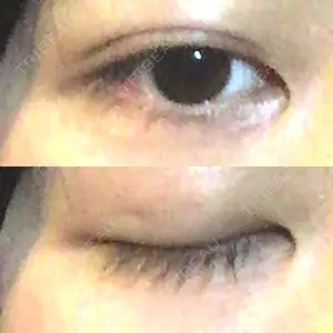 口コミ
