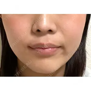 Rinato Beauty Clinic口コミ