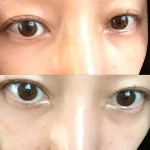 APOLLO BEAUTY CLINIC口コミ