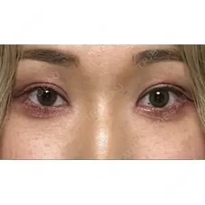 口コミ
