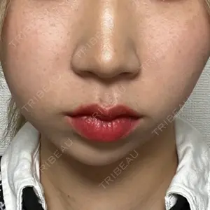 口コミ