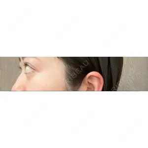 APOLLO BEAUTY CLINIC口コミ