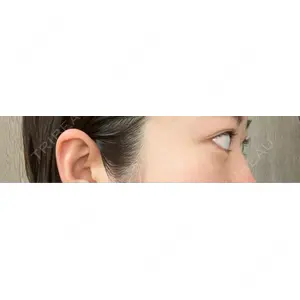 APOLLO BEAUTY CLINIC口コミ