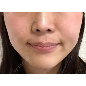 Rinato Beauty Clinic口コミ