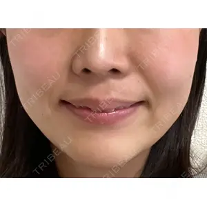Rinato Beauty Clinic口コミ