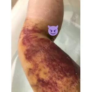 オアシス美容外科口コミ