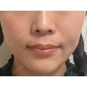 Rinato Beauty Clinic口コミ
