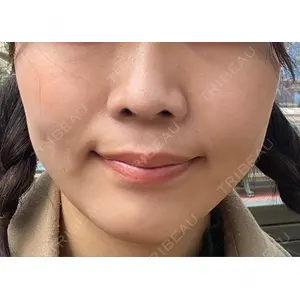 Rinato Beauty Clinic口コミ