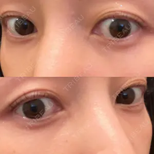 APOLLO BEAUTY CLINIC口コミ