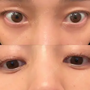 APOLLO BEAUTY CLINIC口コミ