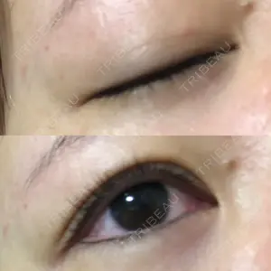 あじまビューティークリニック口コミ