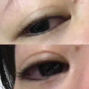 あじまビューティークリニック口コミ