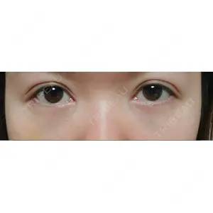 APOLLO BEAUTY CLINIC口コミ