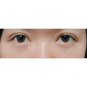 APOLLO BEAUTY CLINIC口コミ