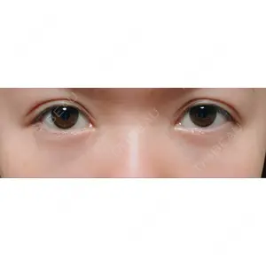 APOLLO BEAUTY CLINIC口コミ