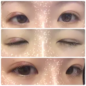 口コミ