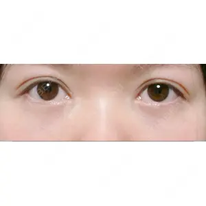 APOLLO BEAUTY CLINIC口コミ