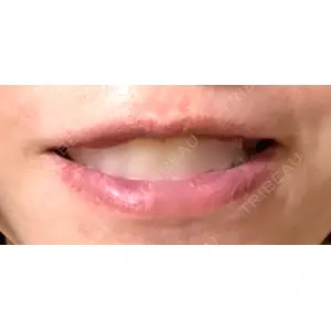 口コミ