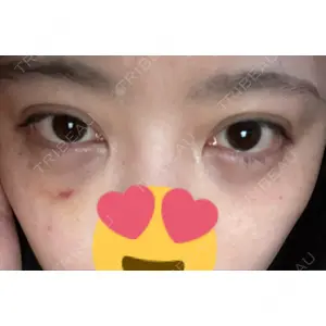 東京イセアクリニック口コミ