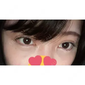 東京イセアクリニック口コミ