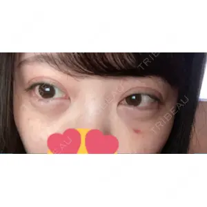 東京イセアクリニック口コミ