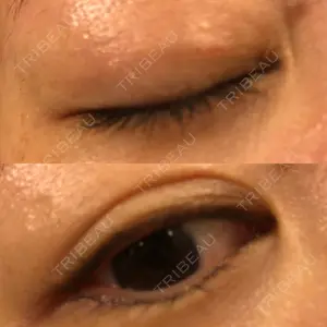 あじまビューティークリニック口コミ