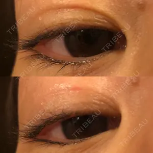 あじまビューティークリニック口コミ