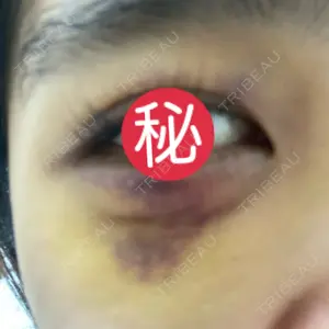 JBCジュノビューティークリニック 新宿三丁目院口コミ