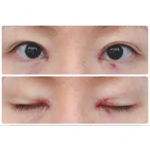 いちのせ形成外科・皮膚科 眼瞼＆フェイスクリニック口コミ